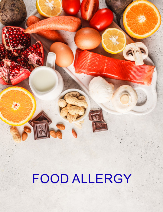 ارتباط آلرژی غذایی با عود مجدد بیماری ام اس