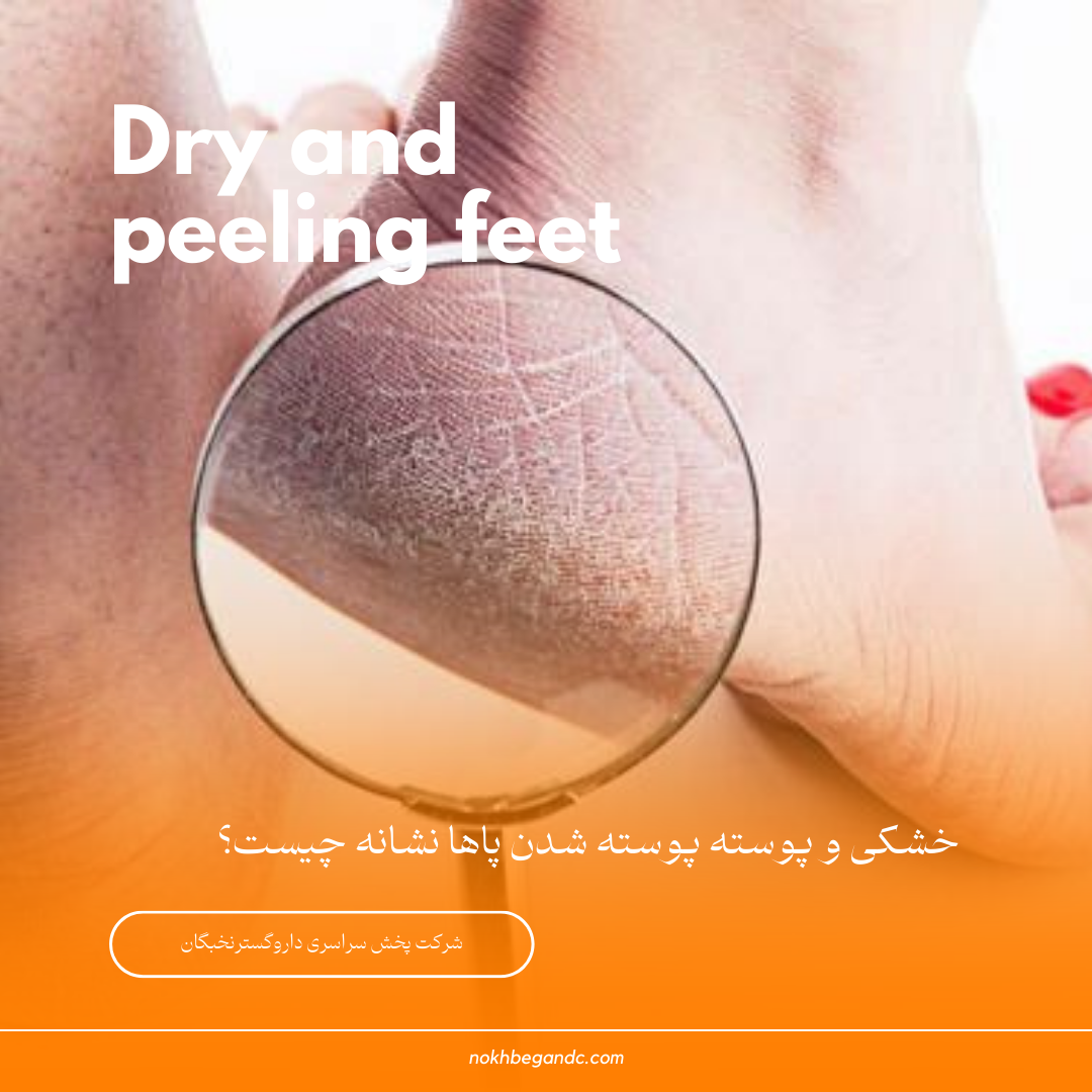 خشکی و پوسته پوسته شدن پاها نشانه چیست؟ 